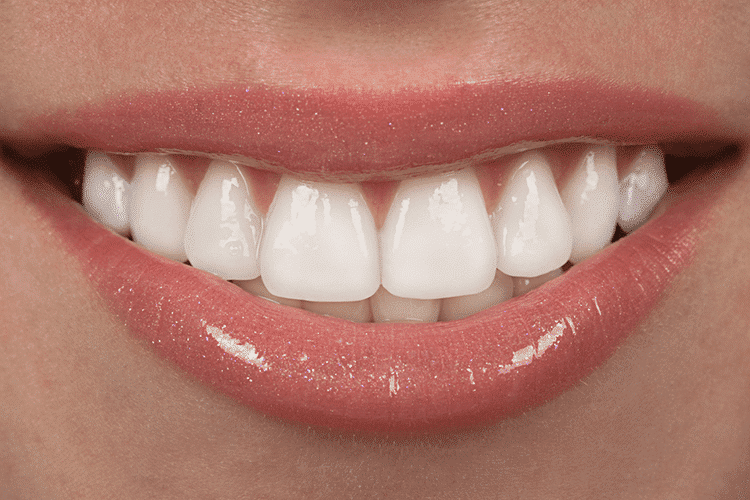 Chipped Tooth Chipped Tooth