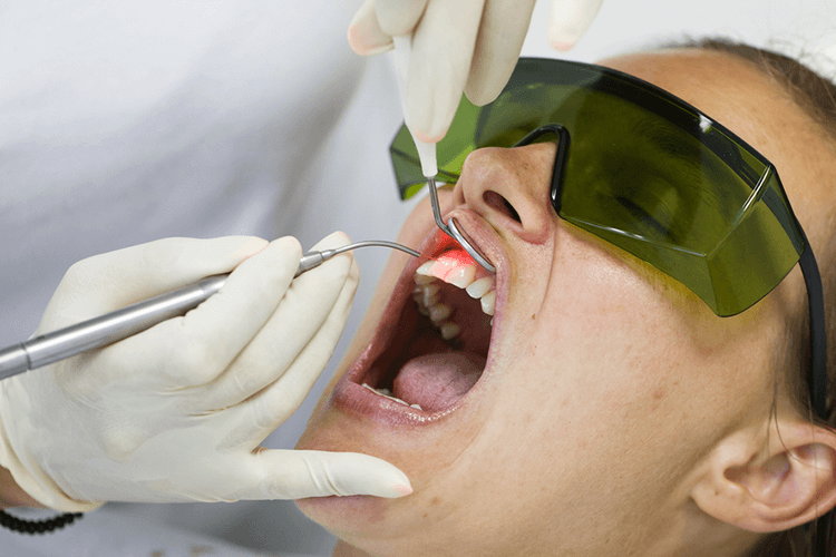 Gums Problem Gums Problem