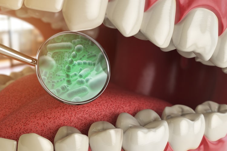 Bad Breath Bad Breath