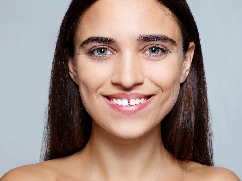 Gaps Between Teeth Gaps Between Teeth