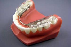 Gelb appliance Gelb appliance