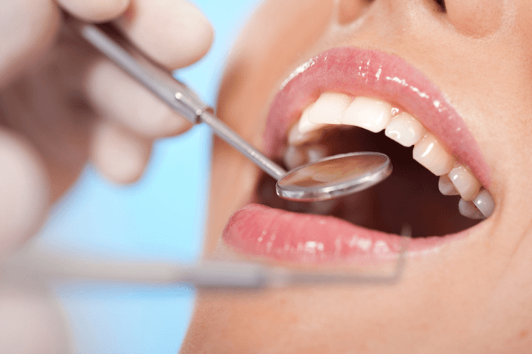 Cavity Cavity
