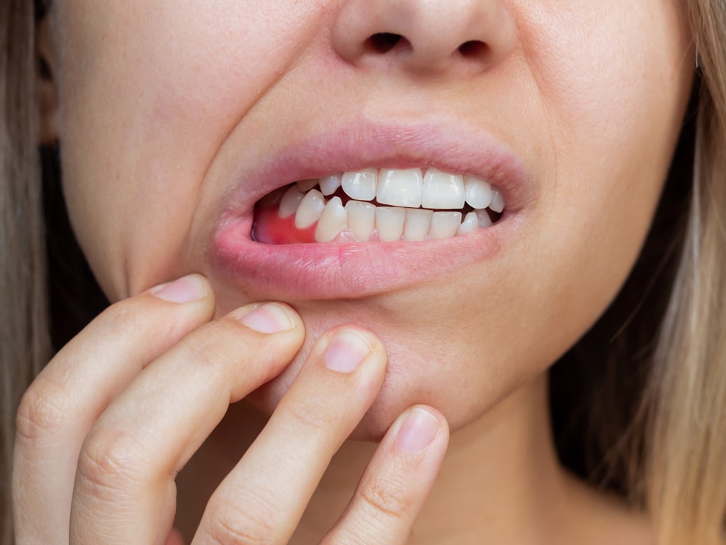 Gums Problem Gums Problem