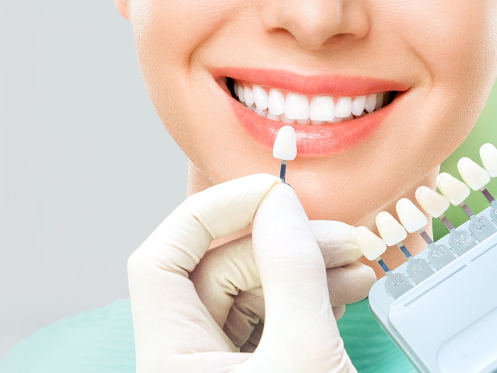 Teeth Whitening Teeth Whitening